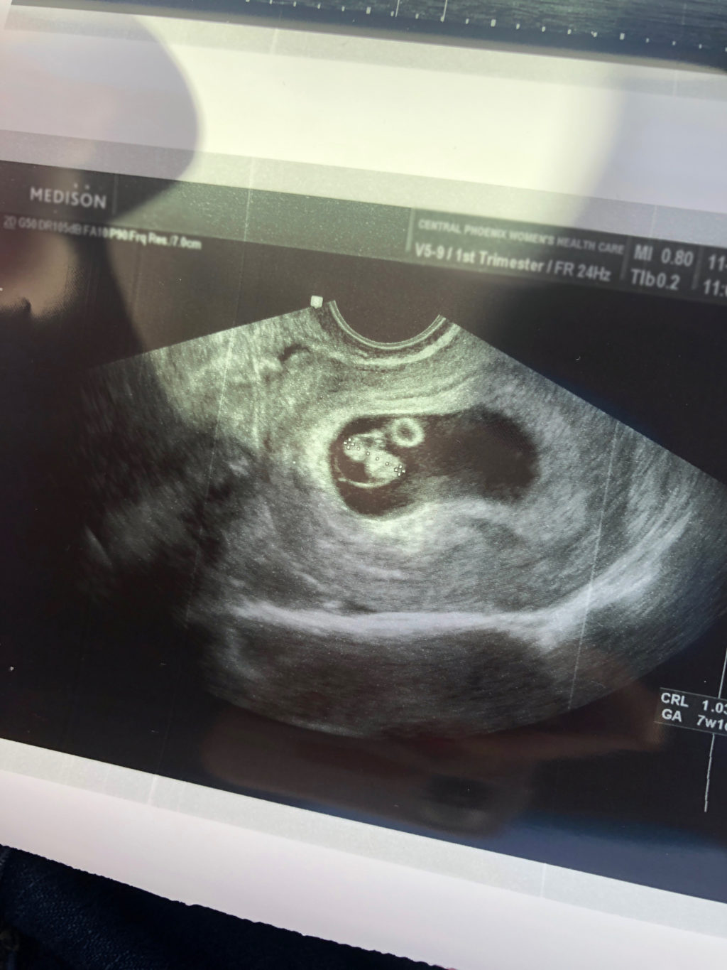 We’re Having A Child! How We Discovered Out + How We Informed Our Household
